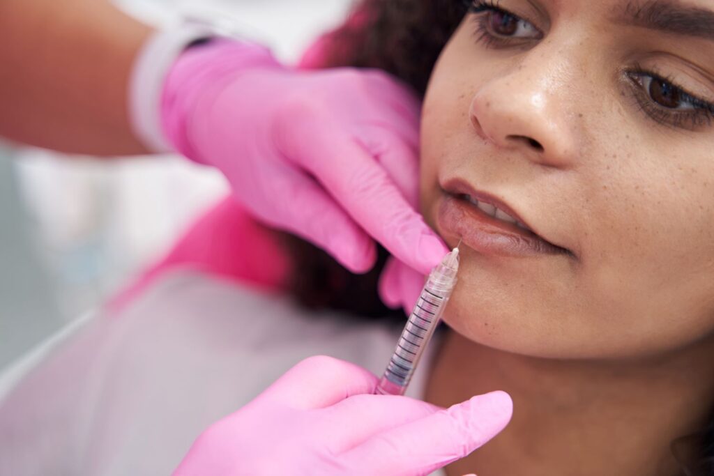 Dermal filler benefits